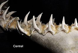Central lower teeth