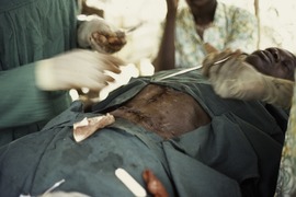 Suturing the wound after an surgical operation, Sara, Guinea-Bissau, 1974