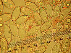 Korvasienen itiöitä mikroskooppikuvassa.