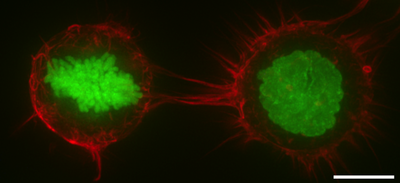 F-actin distribution in the cell cortex as shown by rhodamine phalloidin staining of HeLa cells that constitutively express Histone H2B-GFP to mark chromosomes. F-actin is thus red, while Histone H2B is displayed in green. The left hand cell is in mitosis, as demonstrated by chromosome condensation, while the right hand cell is in interphase(as determined by intact cell nucleus) in a suspended state. In both cases F-actin is enriched around the cell periphery. Scale bar: 10 micrometers. Actin-cortex.png