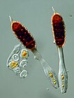 Apiculus van grofwrattige papilroosroest