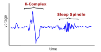 Wrzeciona snu na wykresie aktywności mózgu w czasie spoczynku
