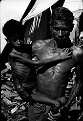 A child suffering extreme starvation in India, 1972 Starved child.jpg