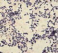 Miniatura para Rothia (bacteria)