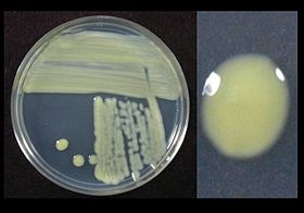 Xanthomonas translúcida Observe o pigmento amarelo. (2013)