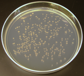 Ecoli colonies.png