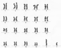 ハツカネズミ（オス、20対40本、性染色体XY）