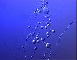Sarfus image of lipid vesicles Sarfus.LipidVesicles.jpg