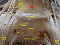 Presacral space.Deep dissection. Anterior view.