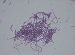Vignette pour Bacillus thuringiensis