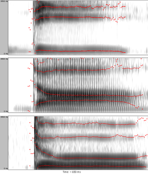 Spectrograms of the syllables 