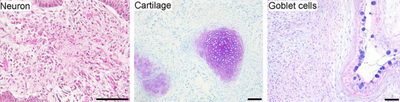 Three germ line cells/tissues differentiated from iPSCs: neurons (ectoderm), cartilage (soft bone, mesoderm) and goblet cells in intestine (endoderm) Three germ line cells differentiated from iPSCs.png