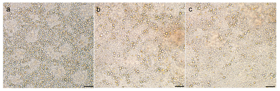 Zellen im Ruhestadium (RSCs) von A. anophagefferens Stamm CCMP1984 nach längerer Lagerung (von l. nach r.: 1, 2 und 3 Monate); Balken 10 µm.[1]