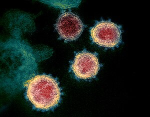 Novel Coronavirus SARS-CoV-2.jpg