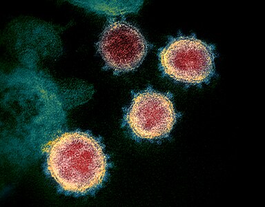 Imatge de microscòpia electrònica (acolorida) mostrant el virus SARS-CoV-2, causant de la COVID-19. Les estructures de la part externa del virus recorden a una corona, donant nom al grup de virus als quals pertany el SARS-CoV-2, els coronavirus.