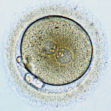 First day of human embryo development, by NinaSes