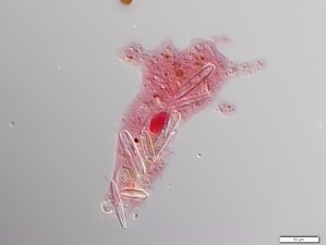 Collection Penard MHNG Specimen 05bis-1-1 Amoeba proteus.tif