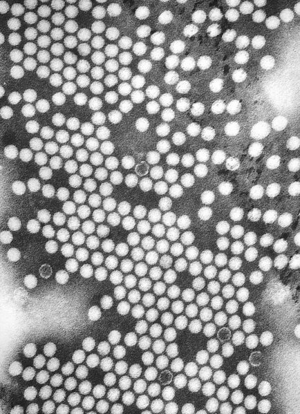 A transmission electron microscope image of poliovirus