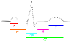 Ondas e segmentos do eletrocardiograma