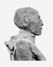 Mummy of Ramesses III (side view). Ramses III mummy head profile.png