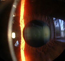 corneal images