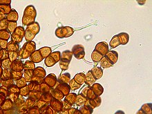 Microscopic image of teliospores Puccinia helianthi (teliospores).jpg