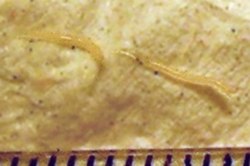 Two pinworms, captured on emergence from the anus. Markings are 1 mm apart