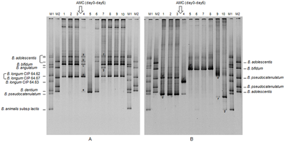 TTGE profiles representing the bifidobacterial diversity of fecal samples from two healthy volunteers (A and B) before and after AMC (Oral Amoxicillin-Clavulanic Acid) treatment TTGE profiles representing the bifidobacterial diversity of fecal samples journal pone 0050257 g004.png