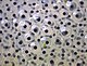 Frogspawn