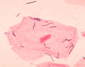 L. acidophilus
