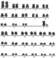 ウマ（オス、32対64本、性染色体XY）