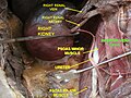 Inferior vena cava