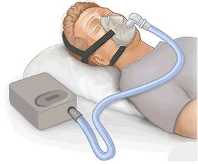 CPAP.png