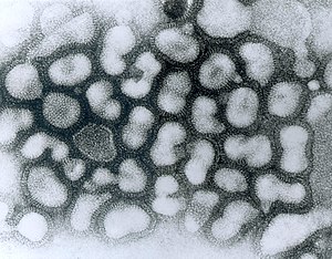 Transmission electron micrograph of influenza ...