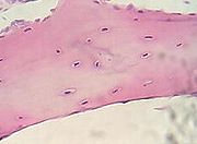 Tulang, nukleus sel (biru-ungu), matriks tulang (merah jambu).