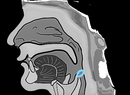 ㅇ is the mimic of the throat hole.