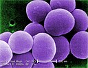 http://upload.wikimedia.org/wikipedia/commons/thumb/8/80/Staphylococcus_aureus_VISA.jpg/128px-Staphylococcus_aureus_VISA.jpg