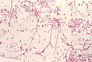 L.pneumophila Gram boyama