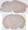 Сагитални пресек (горе) коронални пресек (доле) мишјег мозга