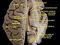 Ventricles of brain and basal ganglia. Superior view. Horizontal section. Deep dissection.
