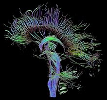 An image of neural pathways in the brain taken using diffusion tensor imaging DTI-sagittal-fibers.jpg