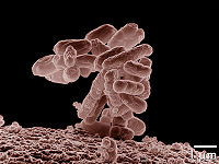 Žarninės lazdelės (Escherichia coli)