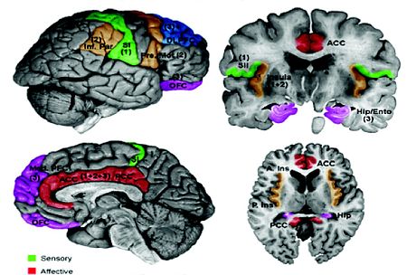 Centers of the Brain effected by pain