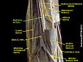 Arteria brachiale