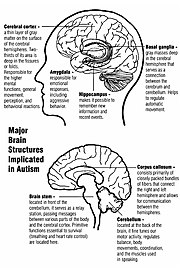 Autism affects many parts of the brain.