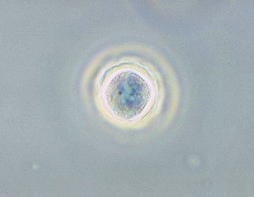 Fotomicrografia de contraste de fase de um cisto de Acanthamoeba polyphaga.