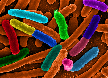 English: These are e Coli.