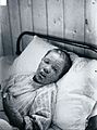 Ethel Cromwell (with smallpox)[4]