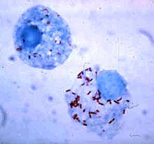 两个内部有很多红色的弧状原核生物的细胞