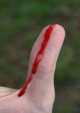Свежая кровоточащая рана на пальце.